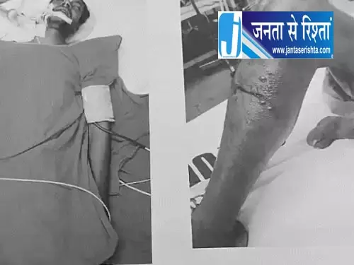 घायल युवक के ऑपरेशन में लापरवाही, नस कट जाने से मौत घायल युवक के ऑपरेशन में लापरवाही, नस कट जाने से मौत