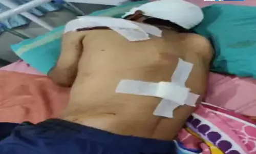 पानी बोर चालू करने को लेकर विवाद, ऑटो ड्राइवर को कुल्हाड़ी से मारा पानी बोर चालू करने को लेकर विवाद, ऑटो ड्राइवर को कुल्हाड़ी से मारा