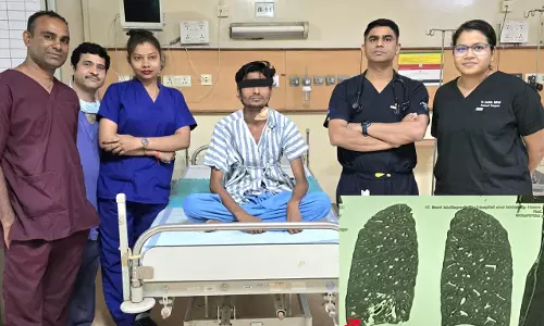 अम्बेडकर अस्पताल में हाई-रिस्क लंग ऑपरेशन सफल, मरीज को मिला नया जीवन