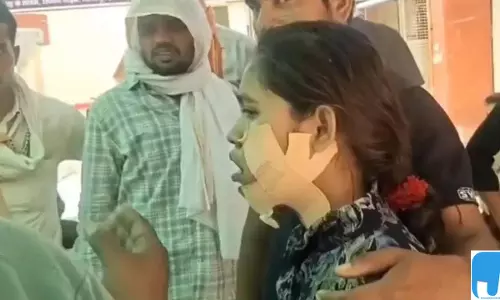 मेडिकल कॉलेज में बड़ा लापरवाही मामला: गलत जबड़े का ऑपरेशन और मारपीट के आरोप