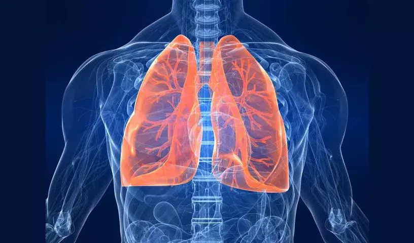 Health Alert: तेलंगाना और आंध्र में नॉन-स्मोकिंग महिलाओं में लंग कैंसर बढ़ा Health Alert: तेलंगाना और आंध्र में नॉन-स्मोकिंग महिलाओं में लंग कैंसर बढ़ा