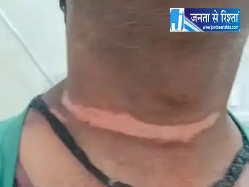 मालवाहन की रस्सी में फंसकर मरते-मरते बचा बाइक सवार मालवाहन की रस्सी में फंसकर मरते-मरते बचा बाइक सवार