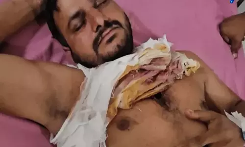 गुटखा विवाद को लेकर फायरिंग, दो लोग घायल, एक की हालत गंभीर गुटखा विवाद को लेकर फायरिंग, दो लोग घायल, एक की हालत गंभीर