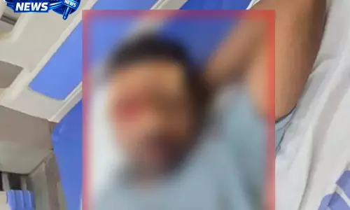 पैतृक जमीन विवाद में दो भाइयों के परिवार भिड़े, लाठी-डंडे और कुल्हाड़ी से हमला