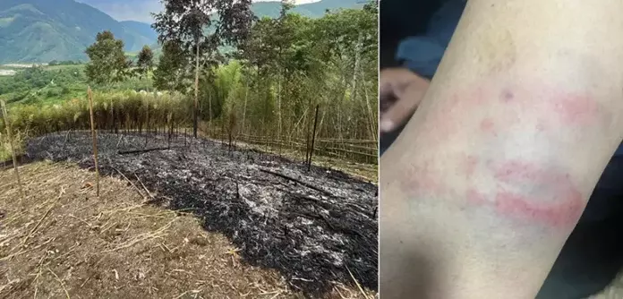 Arunachal: जंगल की आग का इंस्पेक्शन हिंसक हो गया Arunachal: जंगल की आग का इंस्पेक्शन हिंसक हो गया