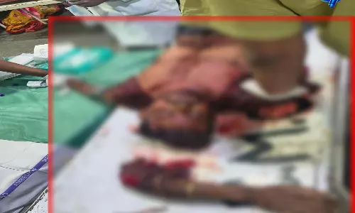 सरस्वती नगर रेलवे स्टेशन पर दर्दनाक हादसा, युवक का हाथ कटकर अलग