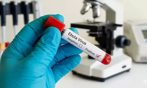 Bengaluru: इबोला आशंका से हड़कंप, युगांडा से लौटी महिला आइसोलेशन में भर्ती Bengaluru: इबोला आशंका से हड़कंप, युगांडा से लौटी महिला आइसोलेशन में भर्ती