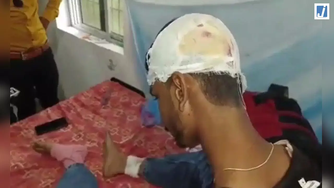 रैगिंग बनी हिंसा: जूनियर छात्र पर लाठी-डंडों और चाकू से हमला, 20 पर FIR दर्ज रैगिंग बनी हिंसा: जूनियर छात्र पर लाठी-डंडों और चाकू से हमला, 20 पर FIR दर्ज