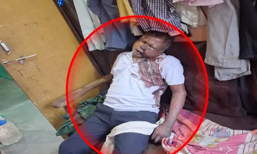 कातुलबोर्ड वार्ड में अधेड़ की घर में मिली सड़ी-गली लाश, फैली सनसनी