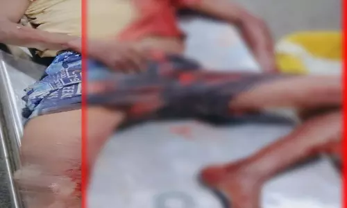 Raipur Breaking: तेलघानी नाका के पास चाकूबाजी, युवक की मौत Raipur Breaking: तेलघानी नाका के पास चाकूबाजी, युवक की मौत