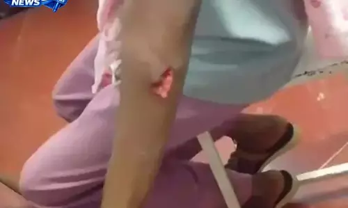 खेत में मक्का तोड़ते समय युवती पर भालू का हमला, हाथ में गंभीर चोट