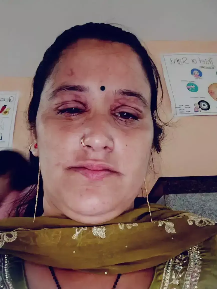 Mandi: कुकर विस्फोट की घटना के बाद यूनियन ने सहायता की मांग उठाई Mandi: कुकर विस्फोट की घटना के बाद यूनियन ने सहायता की मांग उठाई