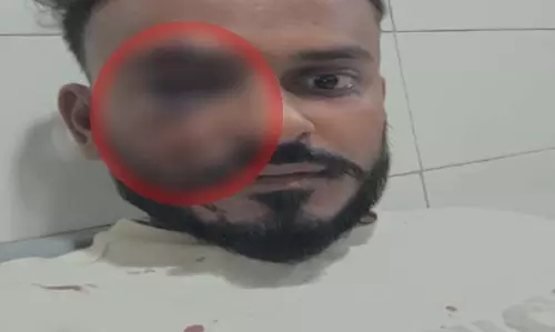 रायपुर में पुराने पैसों के विवाद पर युवक से मारपीट, FIR दर्ज