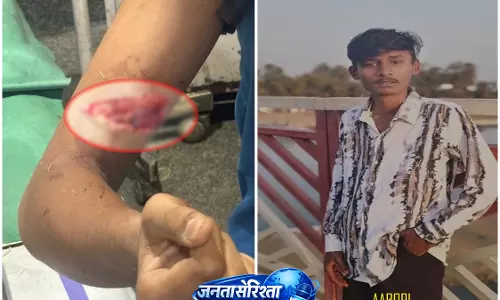 Raipur Breaking: नाबालिग पर थर्माकोल कटर से किया जानलेवा हमला, FIR दर्ज