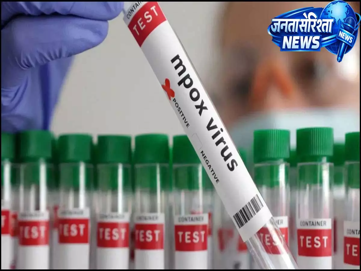 डेट्रॉइट एयरपोर्ट पर रोके गए अमेरिकी लैब वैज्ञानिक, कांगो से Mpox वायरस लाने का आरोप डेट्रॉइट एयरपोर्ट पर रोके गए अमेरिकी लैब वैज्ञानिक, कांगो से Mpox वायरस लाने का आरोप