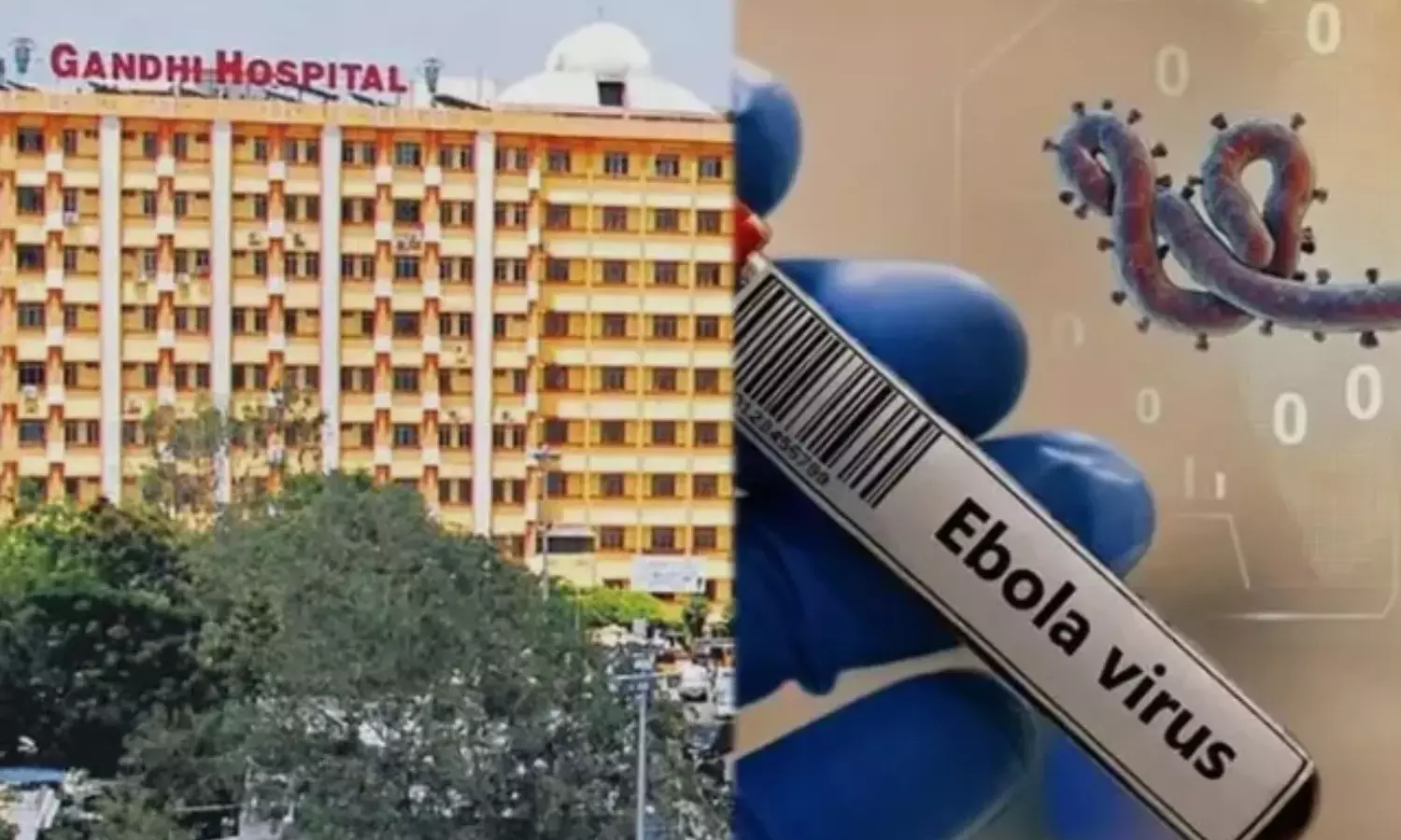 Gandhi Hospital में इबोला का दूसरा संदिग्ध मामला सामने आया