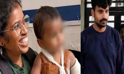 दर्दनाक मामला: बच्चे को रोकने के लिए लाइटर से जलाने का आरोप