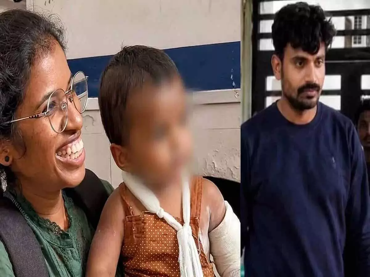 दर्दनाक मामला: बच्चे को रोकने के लिए लाइटर से जलाने का आरोप दर्दनाक मामला: बच्चे को रोकने के लिए लाइटर से जलाने का आरोप