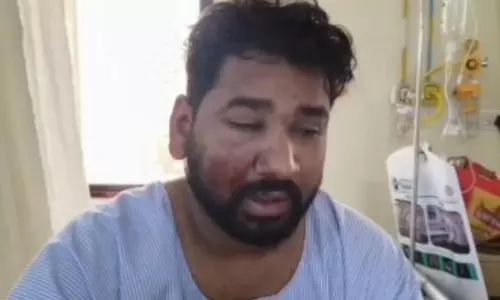 ASI का बेटा हमले में घायल, बोलेरो से कुचल रहे थे बदमाश ASI का बेटा हमले में घायल, बोलेरो से कुचल रहे थे बदमाश