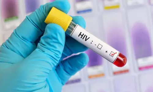 जिला जेल के इतने बंदी मिले HIV पॉजिटिव, हड़कंप जिला जेल के इतने बंदी मिले HIV पॉजिटिव, हड़कंप