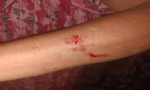 रायपुर में महिला से मारपीट और धार्मिक प्रतिमा तोड़ने की घटना