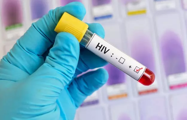 जिला जेल के इतने बंदी मिले HIV पॉजिटिव, हड़कंप जिला जेल के इतने बंदी मिले HIV पॉजिटिव, हड़कंप