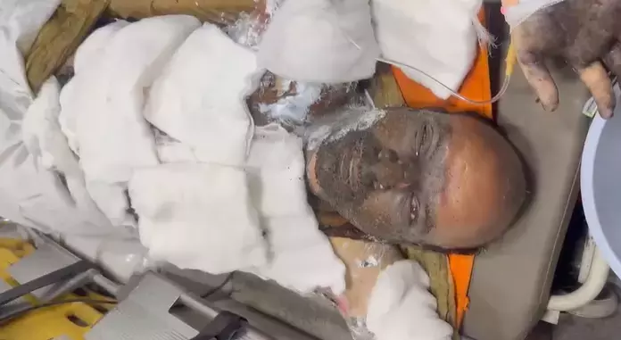 VSP ब्लास्ट: घायल वर्कर का परिवार को दिया गया इमोशनल मैसेज दिल को छू गया VSP ब्लास्ट: घायल वर्कर का परिवार को दिया गया इमोशनल मैसेज दिल को छू गया