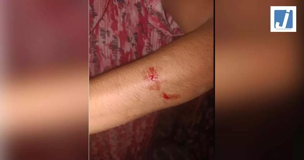 घर में घुसकर महिला के साथ मारपीट, पुलिस जांच में जुटी घर में घुसकर महिला के साथ मारपीट, पुलिस जांच में जुटी
