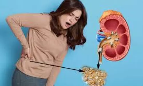 लापरवाही पड़ सकती है भारी, जानें इन 5 संकेतों से पहचानें किडनी स्टोन लापरवाही पड़ सकती है भारी, जानें इन 5 संकेतों से पहचानें किडनी स्टोन