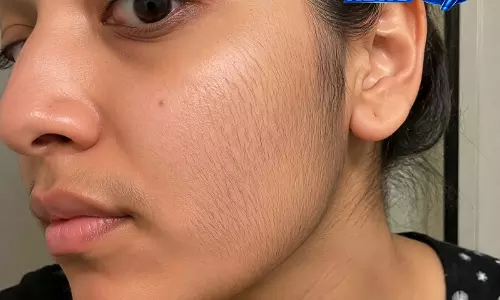 सोशल मीडिया पर वायरल ब्यूटी हैक, facial hair हटाने का दावा सोशल मीडिया पर वायरल ब्यूटी हैक, facial hair हटाने का दावा