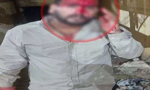 जेल में हुआ बनिया-ईरानी गैंगवार, दो गुटों में हिंसक झड़प, चाकूबाजी में युवक घायल जेल में हुआ बनिया-ईरानी गैंगवार, दो गुटों में हिंसक झड़प, चाकूबाजी में युवक घायल