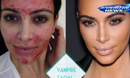 Vampire Facial क्या है? चेहरे पर लगाया जाता है खुद का खून Vampire Facial क्या है? चेहरे पर लगाया जाता है खुद का खून