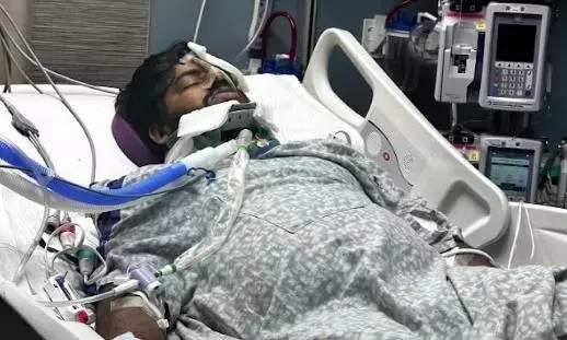 अमेरिका में कार दुर्घटना में हैदराबाद का छात्र गंभीर रूप से घायल; ICU में ज़िंदगी के लिए संघर्ष कर रहा है अमेरिका में कार दुर्घटना में हैदराबाद का छात्र गंभीर रूप से घायल; ICU में ज़िंदगी के लिए संघर्ष कर रहा है