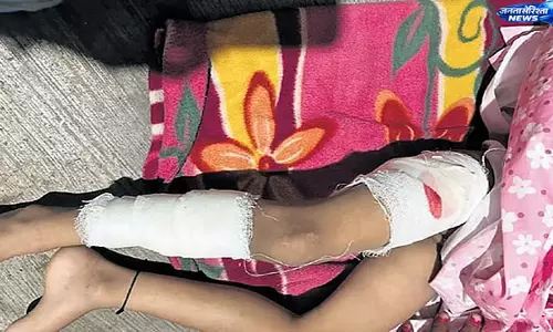 Bengaluru : आवारा कुत्तों का हमला, 3.5 साल की बच्ची घायल, जांच के आदेश
