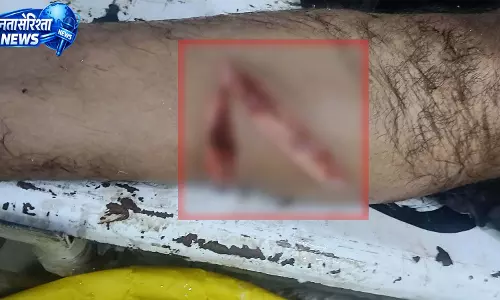 खमतराई बाजार चौक में युवक पर कटर से हमला, हालत गंभीर खमतराई बाजार चौक में युवक पर कटर से हमला, हालत गंभीर