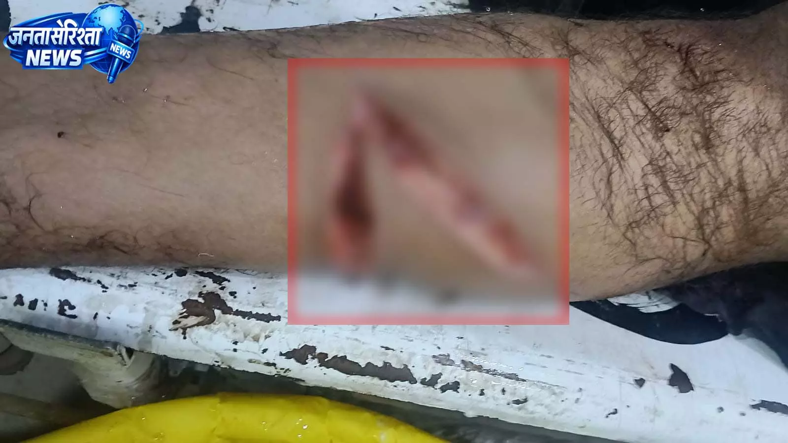 खमतराई बाजार चौक में युवक पर कटर से हमला, हालत गंभीर खमतराई बाजार चौक में युवक पर कटर से हमला, हालत गंभीर