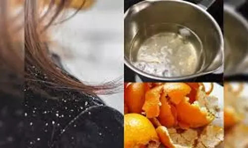 बालों की कई समस्याओं का घरेलू समाधान, नारियल तेल के साथ अपनाएं यह असरदार नुस्खा बालों की कई समस्याओं का घरेलू समाधान, नारियल तेल के साथ अपनाएं यह असरदार नुस्खा