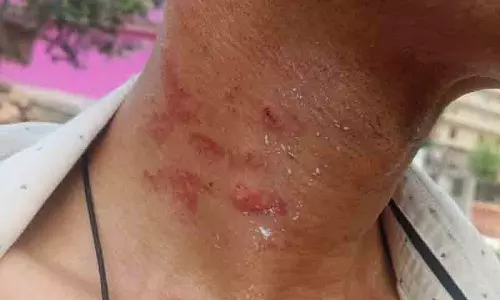 Palampur: अपराध के मामलों में बढ़ोतरी