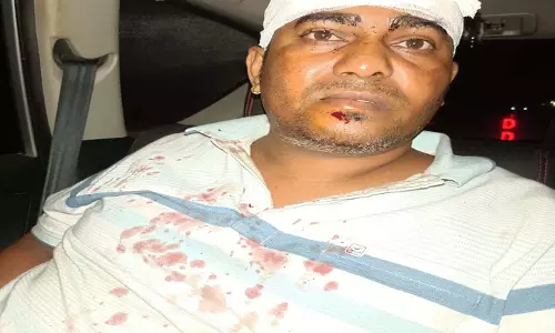 गलत दिशा में खड़े ट्रक से टकराई इनोवा, चालक गंभीर रूप से घायल गलत दिशा में खड़े ट्रक से टकराई इनोवा, चालक गंभीर रूप से घायल