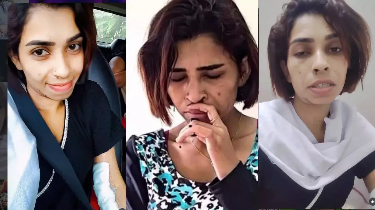 कीमोथेरेपी का दर्द अब नहीं: रेणु सुधी को PICC लाइन ट्रीटमेंट मिला कीमोथेरेपी का दर्द अब नहीं: रेणु सुधी को PICC लाइन ट्रीटमेंट मिला