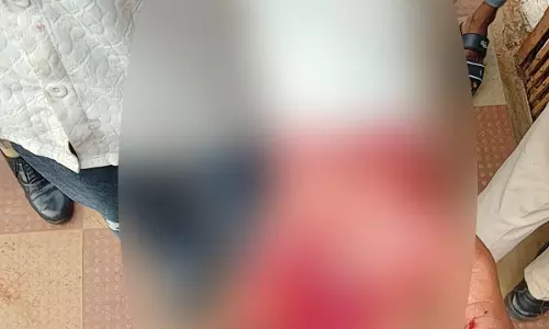 रायपुर : चाकू से युवक का हाथ काटा, डीडी नगर इलाके में वारदात रायपुर : चाकू से युवक का हाथ काटा, डीडी नगर इलाके में वारदात