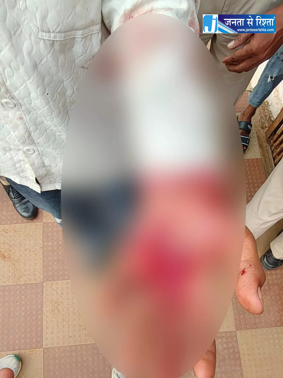 रायपुर : चाकू से युवक का हाथ काटा, डीडी नगर इलाके में वारदात रायपुर : चाकू से युवक का हाथ काटा, डीडी नगर इलाके में वारदात