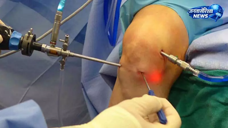 Arthroscopy: झारखंड स्वास्थ्य क्षेत्र में नई उपलब्धि Arthroscopy: झारखंड स्वास्थ्य क्षेत्र में नई उपलब्धि
