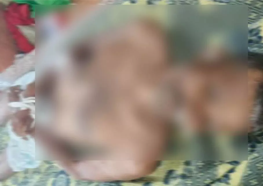 सिर पर चोट का निशान, घायल बुजुर्ग की मौत सिर पर चोट का निशान, घायल बुजुर्ग की मौत