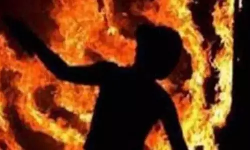 MP ; 250 रुपये के विवाद में युवक को जलाने की कोशिश, हालत गंभीर