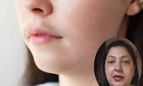 bleach लगाने का सही तरीका और सावधानियां जानें