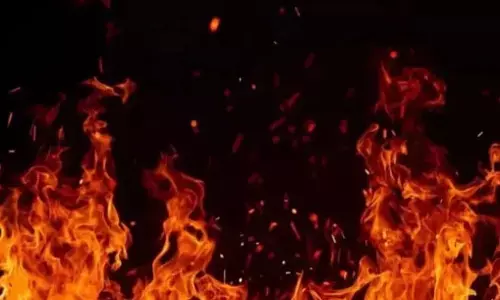 UP : खुडलिया गांव के पास बाईपास पर ट्रक में भीषण आग, लाखों का सामान जलकर राख