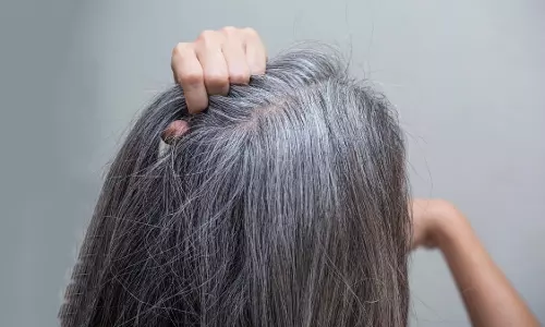 अर्ली व्हाइट हेयर: वजहें और बचाव के आसान उपाय
