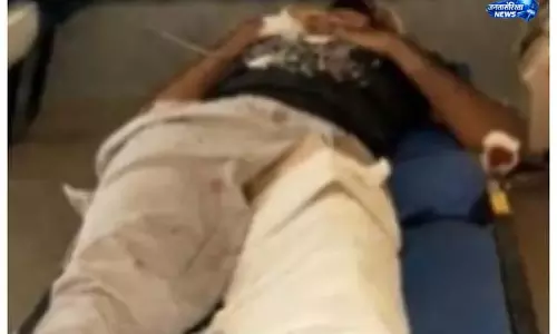 मोतिहारी: अस्पताल में कबाड़ के कार्टन के सहारे टूटा पैर, वीडियो वायरल