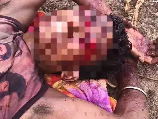 भालू का हमला, युवक गंभीर रूप से घायल, जगदलपुर मेडिकल कॉलेज